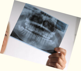X_Ray Diagnostic Dentistry